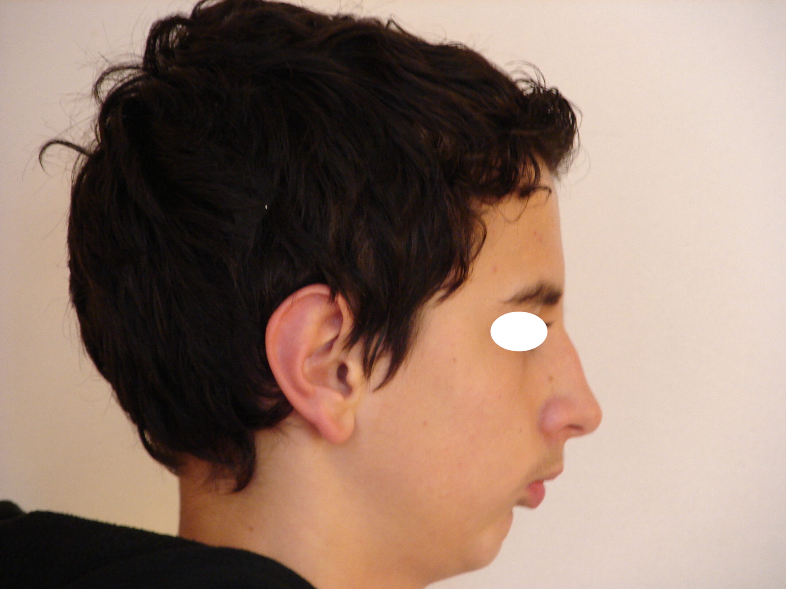 07-12-2009 Visage de Profil avant